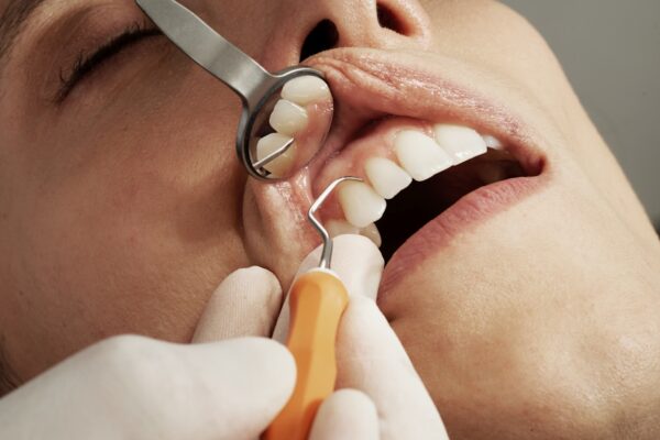 Does Invisalign Hurt? What to Expect at Every Stage of Treatment
