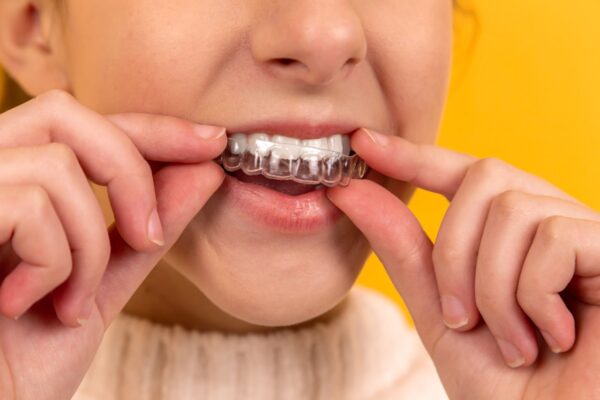 Types of Braces: A Complete Comparison Guide for 2025